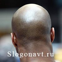 Затылок