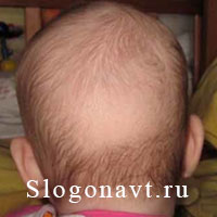 Затылок